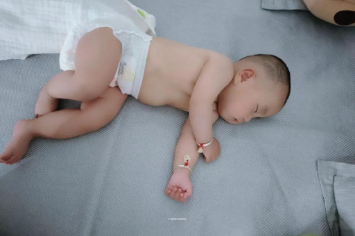 凤城六个月宝宝眼睛散光